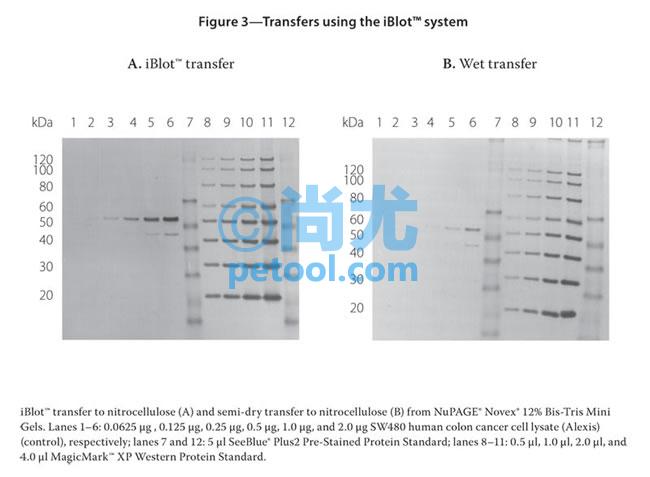 SKU:00022330,iBlot®GelTransferDevice/ӢΫݻתǵƬ