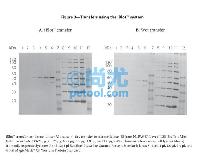 iBlot® Gel Transfer Device/ӢΫݻת Ŵ