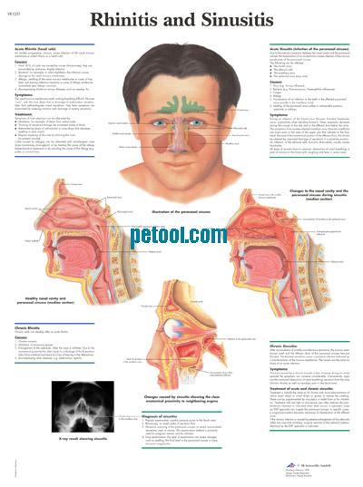 ¹ǺͼRhinitis and Sinusitis  Ŵ